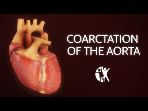 Video: Aorta - Liečba Aorty ľudovými Prostriedkami A Metódami