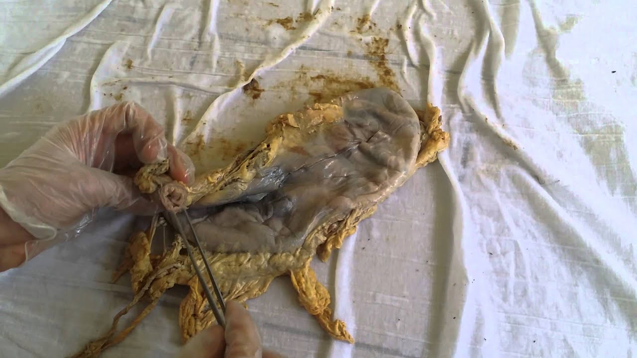 Stomach CADAVER - YouTube