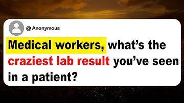 Medical workers, what’s the craziest lab result you’ve seen in a patient?