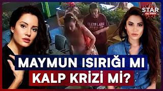 Maymun Isırığı İddia Edilmişti, Ünlü Oyuncunun Ölümüne İlişkin Ön Rapor Tamamlandı | Star Ana Haber