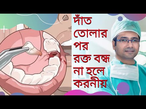 ভিডিও: কীভাবে ক্রীড়াবিদদের পায়ের চিকিত্সা এবং প্রতিরোধ করবেন (ছবি সহ)