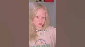 Most striking and rare eye colors! Which color are your eyes?  #features #eyes #eyecolor  #model