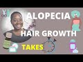 CCC Alopecia: Don't Freak Out Hair Growth Takes Time #ccca #hairgrowth