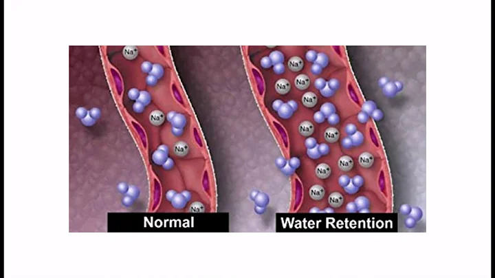 Natural Diuretic Water Pill Guaranteed To Eliminate Water Retention