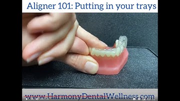 Putting in your Invisalign Trays: Aligner 101