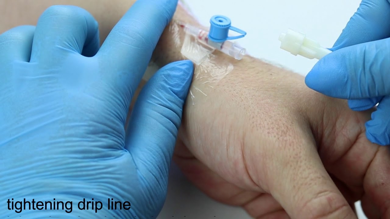 ierburi-spital-c-l-torie-how-to-open-cannula-cap-alaska-stare-ziua