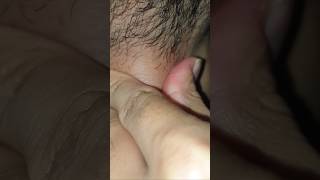 Scratch hair sounds #relaxing #massage #therapy #satisfying #beard #haircare #shorts #video