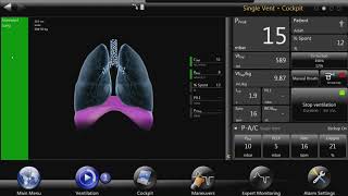 bellavista™ Ventilator: Animated Lung