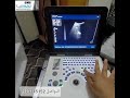 شرح مفصل لكيبورد جهاز سونار شركة اكس اف موديل30وكيفية استخدامة وكيفية اخذ القياسات وضبط الوضوح