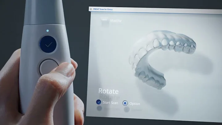 Medit i700 | Better for Patients, Easier for Dentists