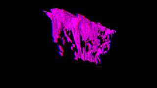 Studying open fractures in CT-scanner - Percolating fracture network (3D)