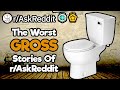 People Reveal The Grossest, Nastiest, Most Disgusting Things (1 Hour Reddit Compilation)