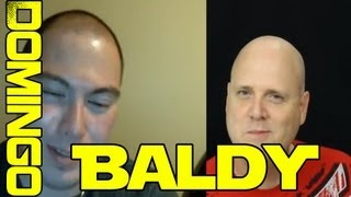 Being Bald.