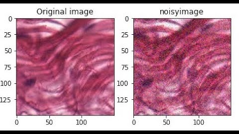 Top Data Augmentation Techniques for Computer Vision