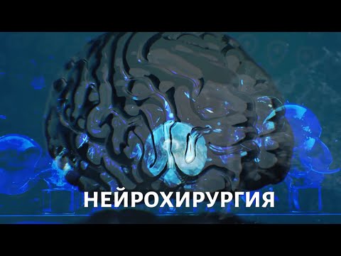 Эпилепсия, опухоль мозга. Нейрохирургия. Медицина будущего