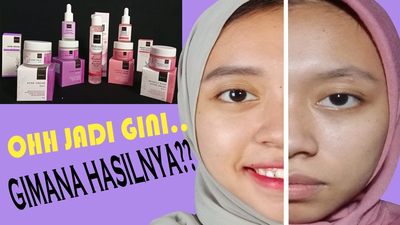 PRODUK TERBARU SCARLETT!! Review Face Wash, Serum, Cream