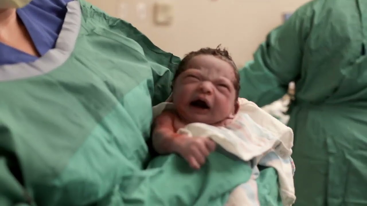 C-section birth story Utah