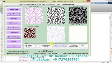Malaria Detection and Classification Using Matlab Project