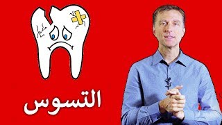 الحل النهائي لتسوس الأسنان | للبالغين والأطفال