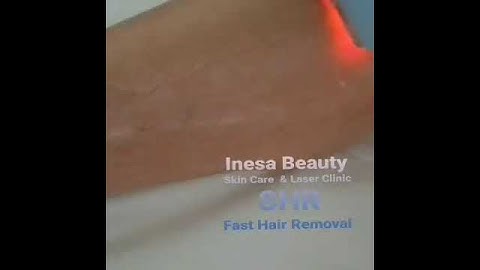 SHR Laser  Fast Hair Removal