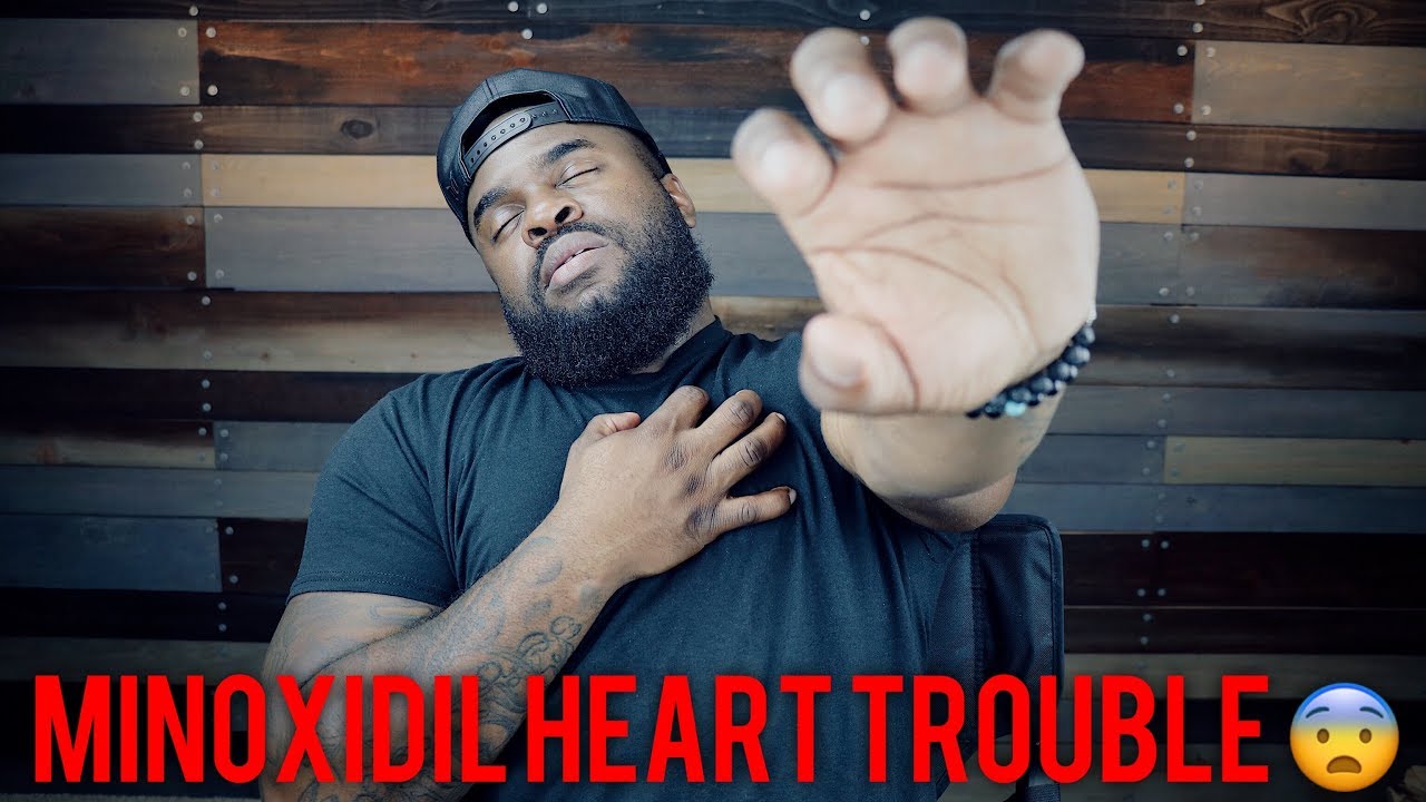Minoxidil Side Effects: 3 Quick and Easy Ways To Stop Minoxidil Heart  Problems - YouTube