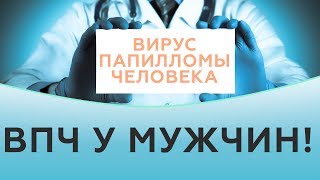 Вирус папилломы человека лечение. Как лечить вирус папилломы человека? ВПЧ у мужчин!