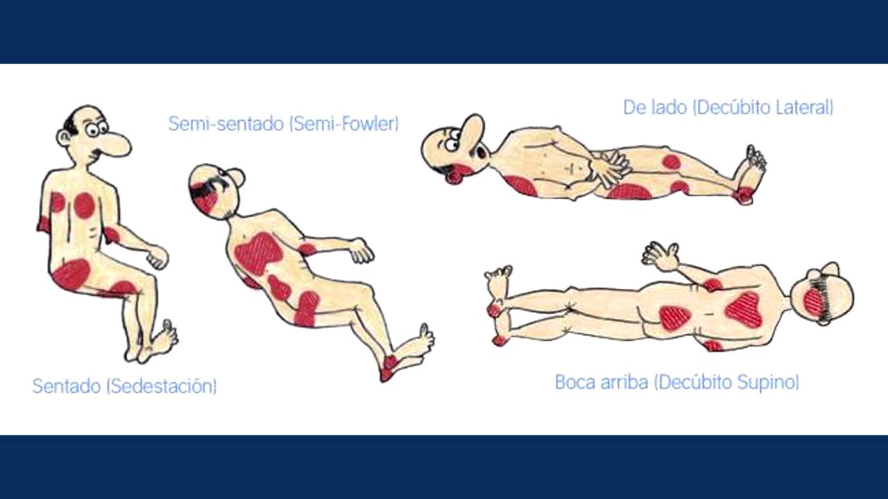 Cuidado del paciente con diabetes en situación de reposo Cuidado del paciente con diabetes en situación de reposo