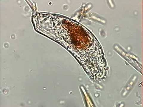 TRICHOCERCA DIURELLA ROTIFERO life facebook