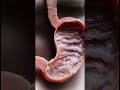 Your Stomach Acid: SECRET SHIELD Inside You 🛡️