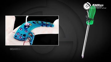 Hombro - Expert Fast AC - Fijación Flexible Acromioclavicula