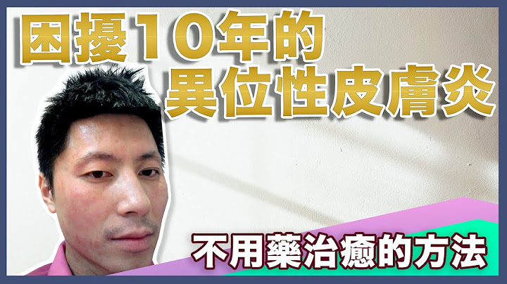 异位性皮肤炎｜ 不靠药物痊愈的方法｜ 免花钱治疗 ｜如何改善肌肤湿疹问题 - 天天要闻