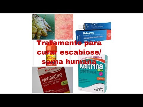 Vídeo: Tratamento Da Sarna: Creme Sem Receita, Medicamentos E Muito Mais