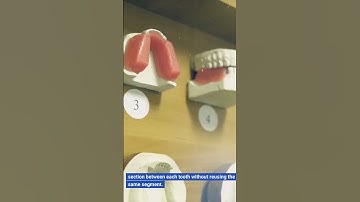 Mastering the Art of Stress-Free Flossing (Step-by-Step)