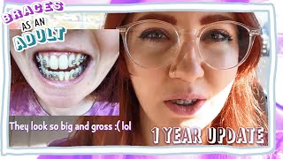 1 Year Braces UPDATE | Bracket Repositioning | Braces as an Adult