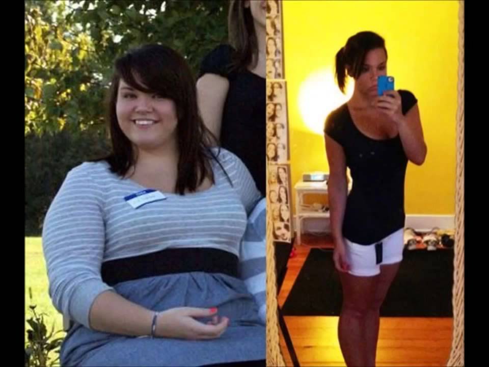 Она сильно похудела. Похудение до и после. До и после похудения девушки. Девушка похудела. Сильное похудение до и после.