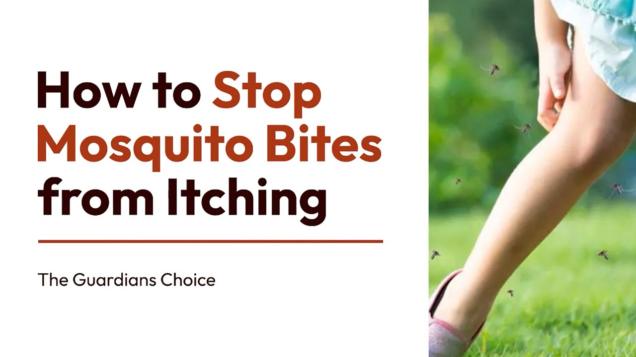 4-ways-to-stop-mosquito-bites-from-itching-how-to-stop-mosquito-bites