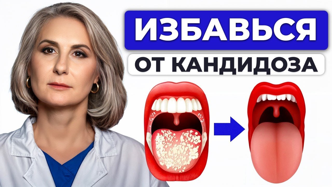 ЭТО поможет вам БЫСТРО и ЛЕГКО справиться с КАНДИДОЗОМ и другими грибковыми инфекциями!
