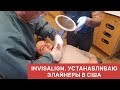 INVISALIGN. УСТАНОВКА ЭЛАЙНЕРОВ В США