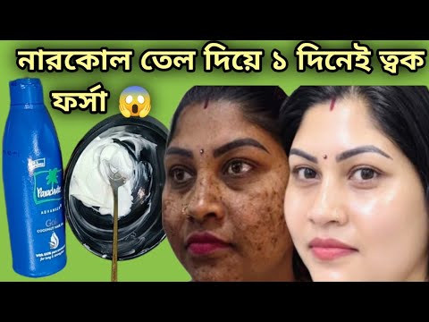 নারকোল তেলের এই উপায় ত্বক পার্লার এর মতো ফর্সা উজ্বল হবে একদিনই Coconut Oil Uses