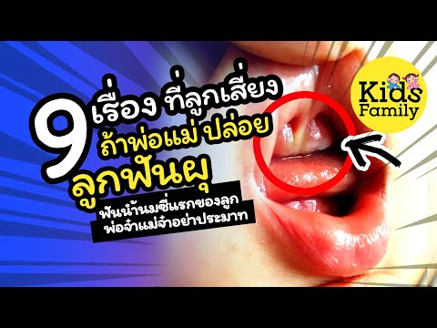 วีดีโอ: ฟันน้ำนมในเด็กเปลี่ยนเป็นฟันกรามได้อย่างไร