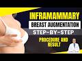 Female Inframammary Breast Augmentation | Surgery Technique,& Results Explained | By Dr. PK Talwar