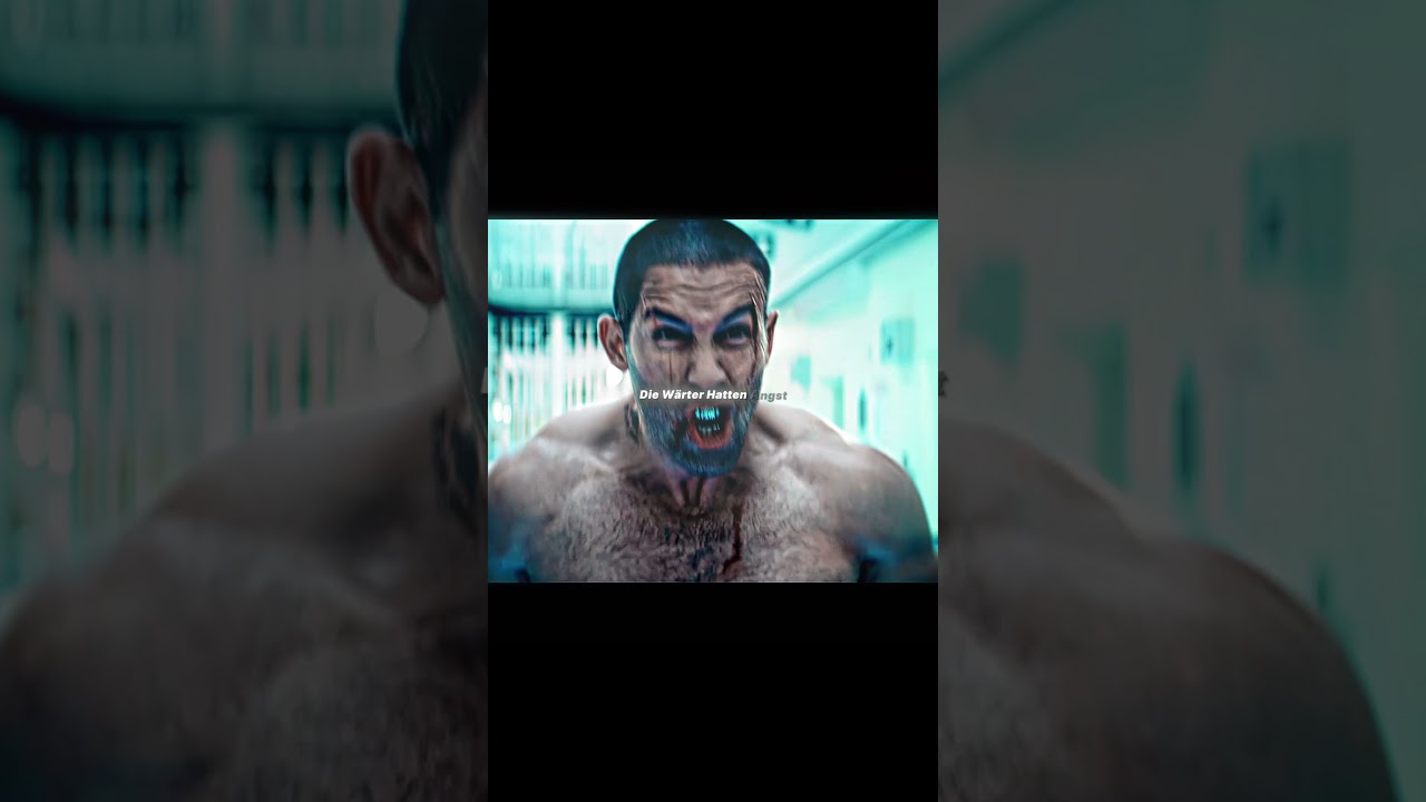 Man brach mir den Kiefer. Der Arzt setzte mir Stahlzähne ein #shorts #movie