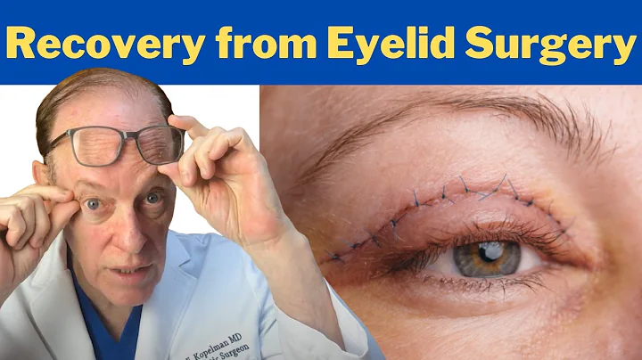 How to Recover from a Blepharoplasty | Plastic Surgeon's Guidance on Eyelid Surgery Recovery - DayDayNews