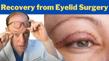 How to Recover from a Blepharoplasty | Plastic Surgeon