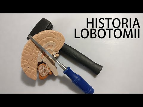 Operacja lecząca dusze - historia lobotomii