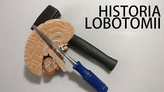 Soul healing procedure - the history of lobotomy
