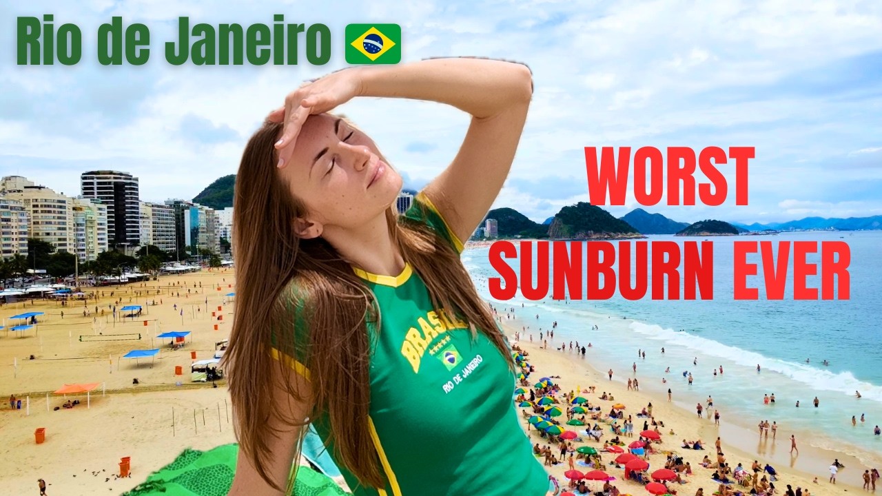 Rio de Janeiro Vlog 🇧🇷 Rain, Copacabana & The WORST Sunburn of My Life