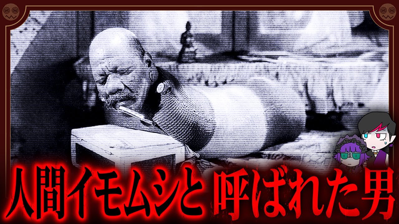 人間イモムシと呼ばれた男「ランディアン王子」の人生【見世物小屋】