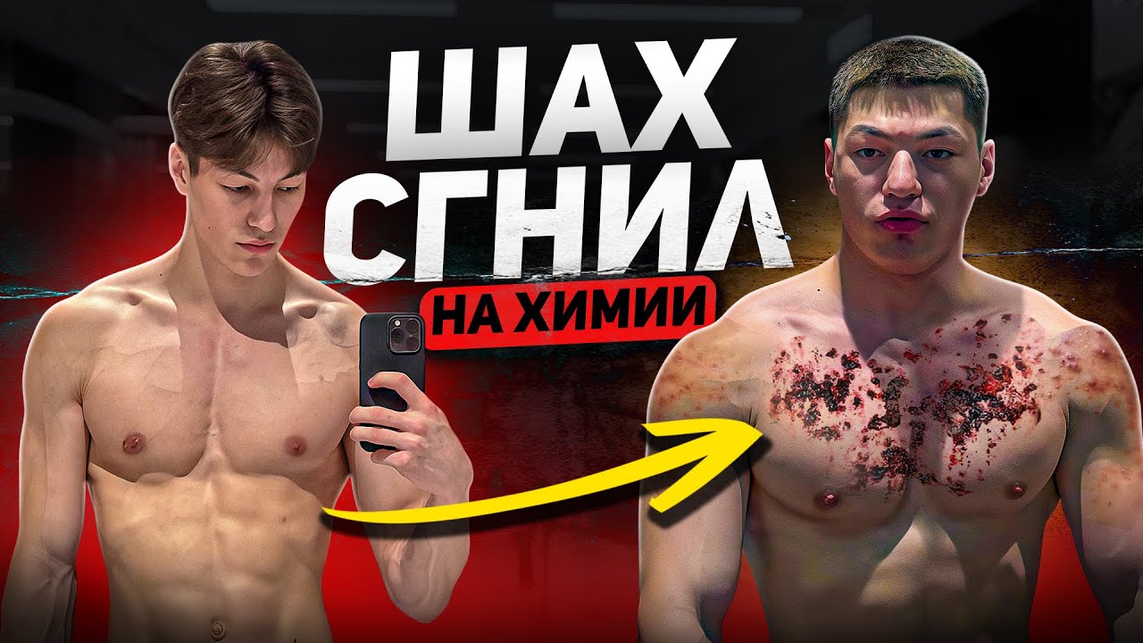 лав соса выбрал неправильный путь / Шах