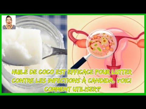 Vidéo: L'huile De Coco Pour Candida: Aide-t-elle? - 3 Traitements Efficaces